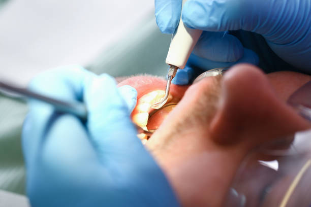 Best Pediatric Emergency Dentist in Rialto, CA